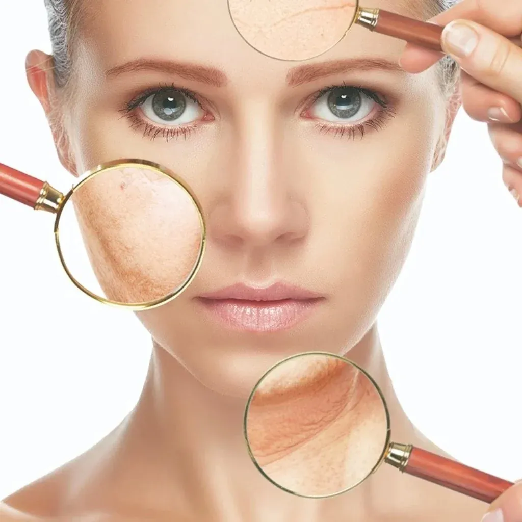 spa.Pigment Peel Behandlung im spa.Five Frankfurt